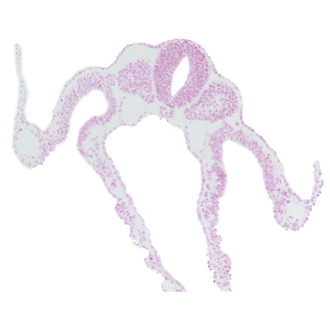 alar plate(s), basal plate, communication between peritoneal cavity and extra-embryonic coelom, dermatomyotome 8 (C-4), left umbilical vein, midgut, notochord, sclerotome, somatopleuric mesoderm, spinal part of neural tube, splanchnopleuric mesoderm, sulcus limitans, umbilical vesicle wall