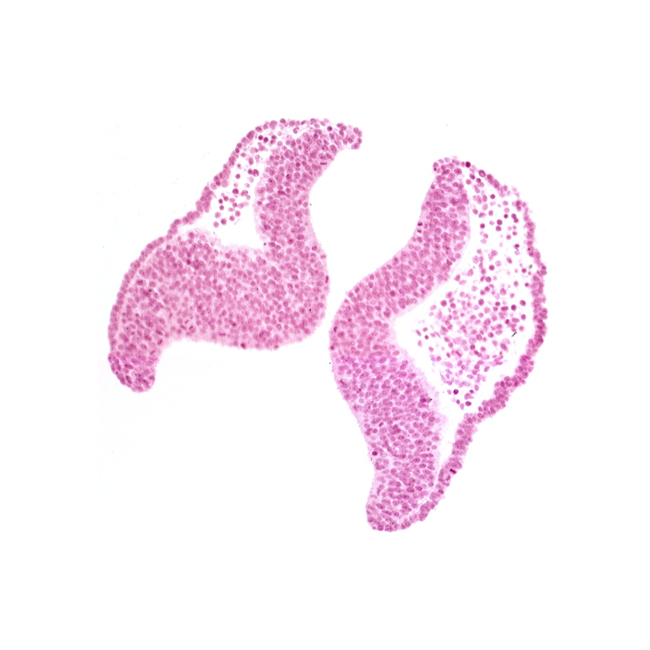 artifact space(s), head mesenchyme, neural fold [diencephalon (D1)], neural fold [diencephalon (D2)], neural fold [mesencephalon (M)], optic sulcus