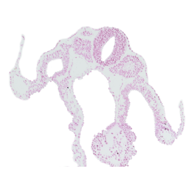 amnion attachment, dermatomyotome 9 (C-5), dorsal aorta, left umbilical vein, midgut, notochord, right umbilical vein, somitocoel 9