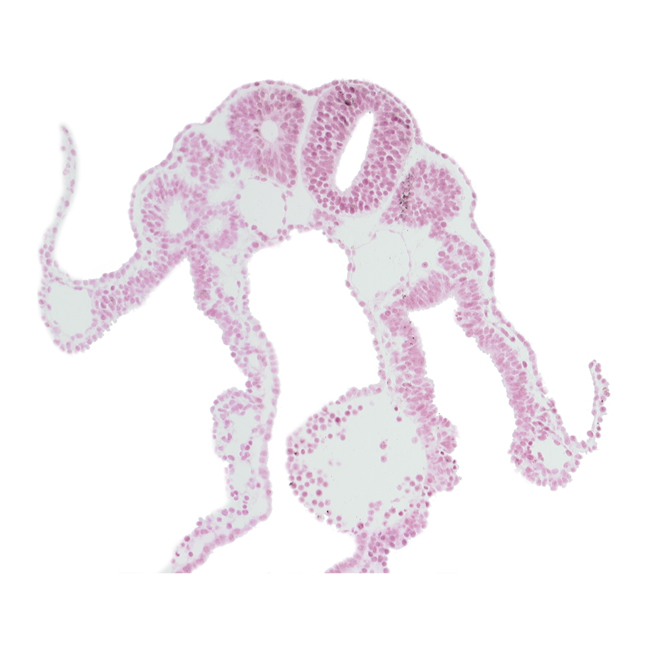 amnion attachment, dermatomyotome 9 (C-5), dorsal aorta, lateral body fold, left umbilical vein, right umbilical vein, surface ectoderm