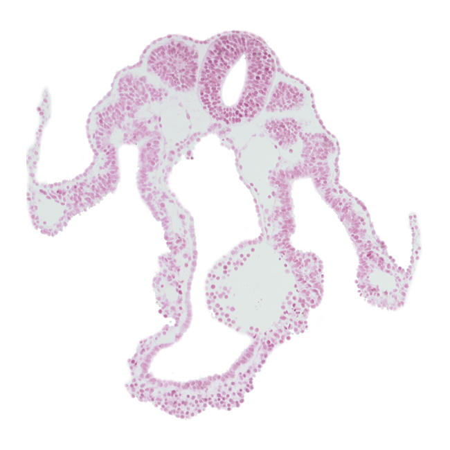 caudal part of dermatomyotome 9 (C-5), cephalic part of somite 10 (C-6), lateral body fold, left umbilical vein, midgut, neural tube, peritoneal cavity, right umbilical vein