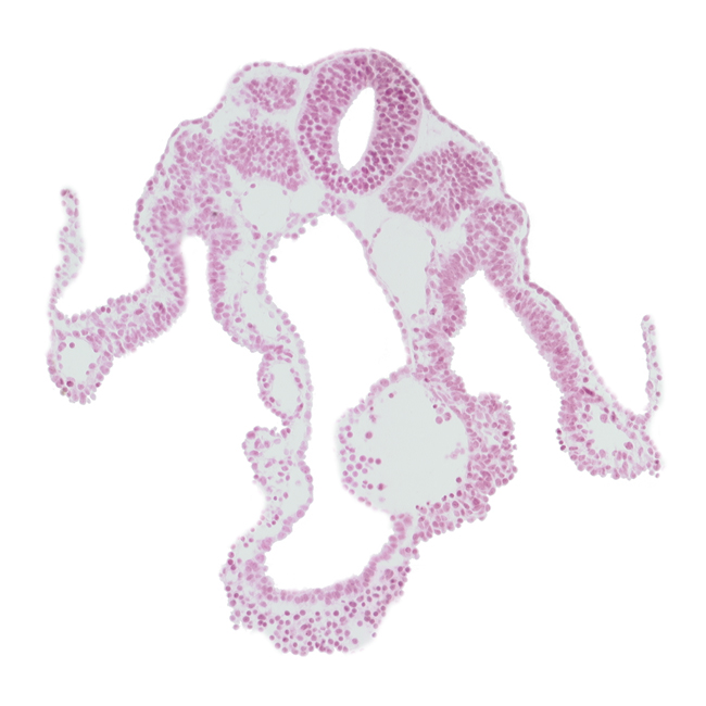 amniotic cavity, caudal part of umbilical vesicle cavity, dorsal aorta, endoderm, left umbilical vein, right umbilical vein, somite 10 (C-6)