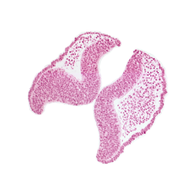 cephalic neuropore, head mesenchyme, junction of neural ectoderm and surface ectoderm, neural fold [diencephalon (D1)], neural fold [diencephalon (D2)], neural fold [mesencephalon (M)], optic nerve primordium (CN II) [diencephalon (D1)], optic sulcus