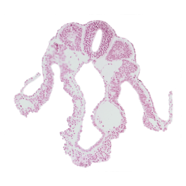 amnion attachment, dorsal aorta, endoderm, left umbilical vein, midgut, neural tube, notochord, somite 10 (C-6), surface ectoderm