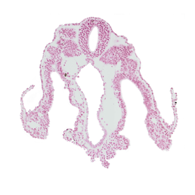 amnion attachment, amniotic cavity, communication between peritoneal cavity and extra-embryonic coelom, dorsal aorta, intermediate mesenchyme, notochord, peritoneal cavity, right umbilical vein, somite 11 (C-7), umbilical vesicle cavity, vitelline (omphalomesenteric) vein