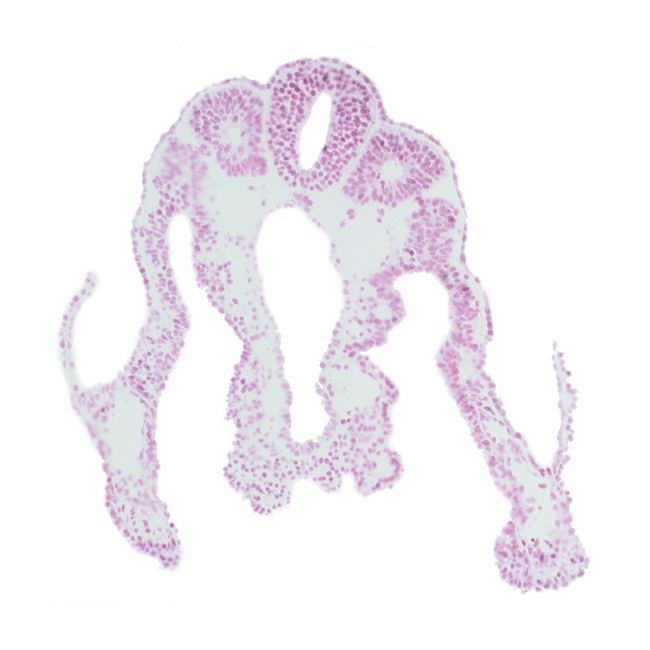 dorsal aorta, intermediate mesenchyme, lateral body fold, midgut, notochord, right umbilical vein, somite 11 (C-7), somitocoel 11