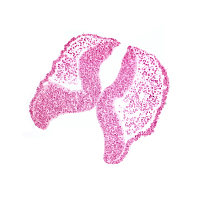 artifact space(s), cephalic neuropore, head mesenchyme, junction of neural ectoderm and surface ectoderm, neural fold [mesencephalon (M)], rhombencephalon (Rh. 1), surface ectoderm