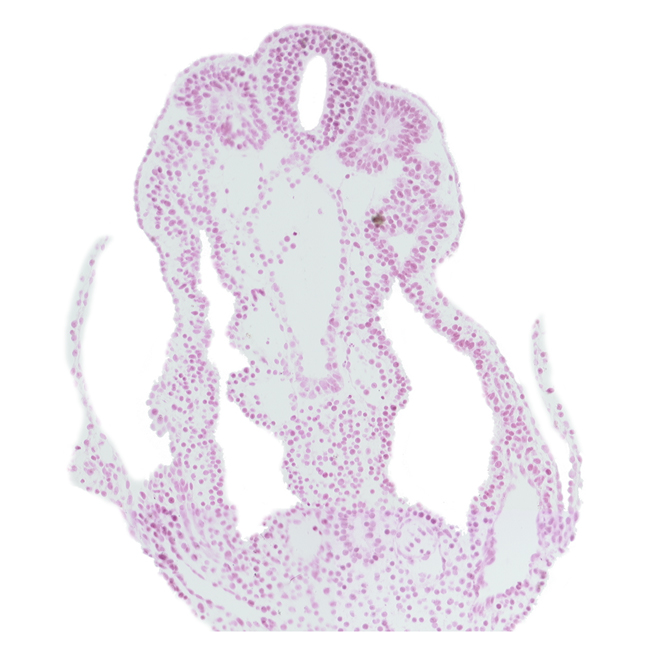 allantois, amnion attachment, amniotic cavity, connecting stalk mesenchyme, hindgut, left umbilical vein, peritoneal cavity (coelom), right umbilical artery, right umbilical vein, somite 12 (C-8), somitocoel 12