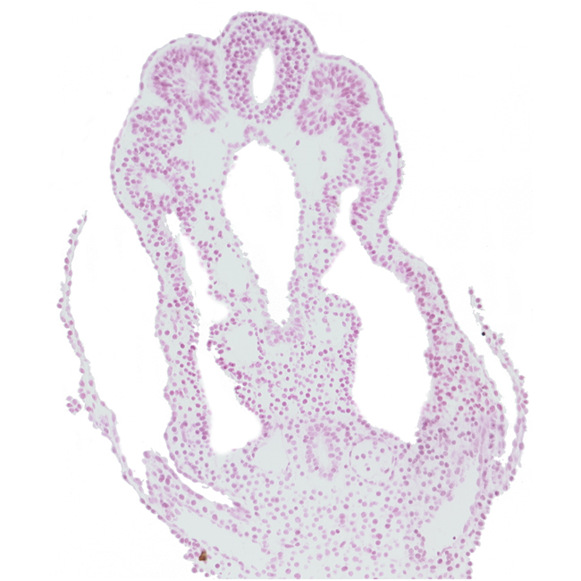 allantois, amnion attachment, amniotic cavity, connecting stalk mesenchyme, hindgut, intermediate mesenchyme, left umbilical artery, left umbilical vein, notochord, right umbilical artery, right umbilical vein, somatopleuric mesoderm, somite 12 (C-8), somitocoel 12, splanchnopleuric mesoderm, tail fold region