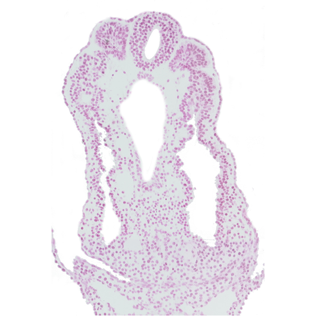 allantois, amnion attachment, dorsal aorta, endoderm, hindgut, intermediate mesenchyme, left umbilical vein, peritoneal cavity (coelom), right umbilical vein, somite 12 (C-8), spinal part of neural tube, tail fold region