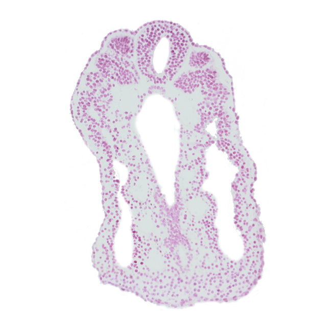 allantois, caudal part of somite 12 (C-8), cephalic part of somite 13 (T-1), dorsal aorta, dorsal aorta plexus, hindgut, junction of allantois and hindgut, somite 12-13 intersegmental region