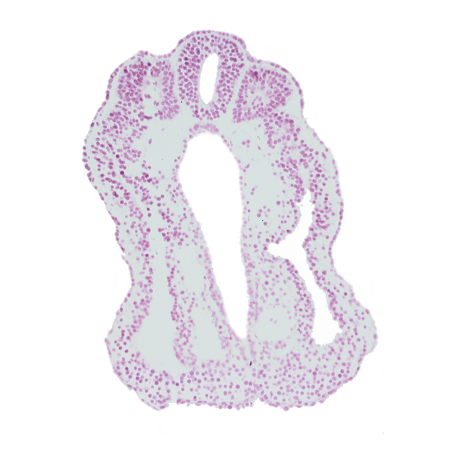 dorsal aorta, dorsal aorta plexus, hindgut, intermediate mesenchyme, left umbilical artery, peritoneal cavity (coelom), right umbilical artery, somite 13 (T-1)