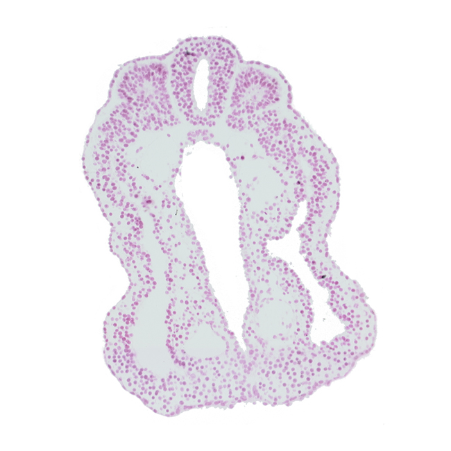 hindgut, left umbilical artery, notochord, right umbilical artery, somite 13 (T-1), somitocoel 13, spinal part of neural tube