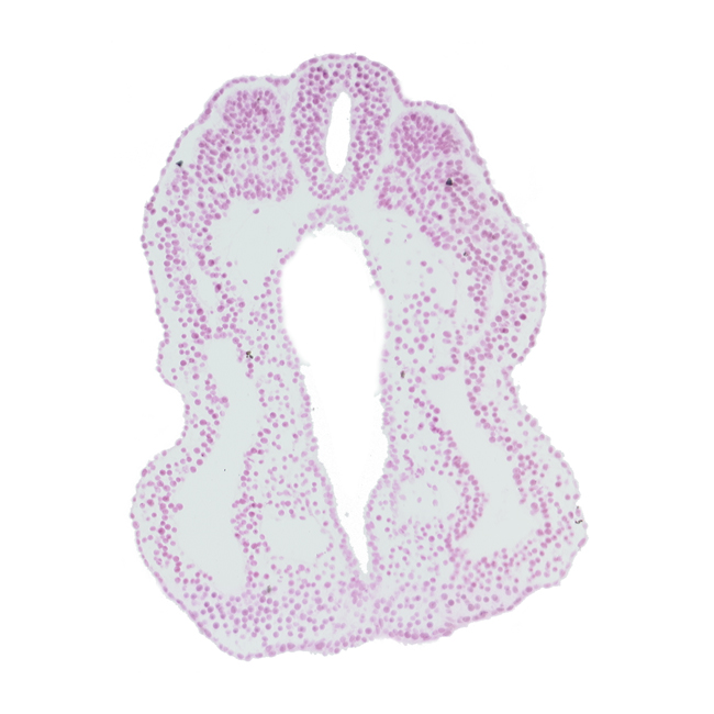 caudal part of somite 13 (T-1), endoderm, hindgut, left umbilical artery, lumen of neural tube, peritoneal cavity (coelom), right umbilical artery