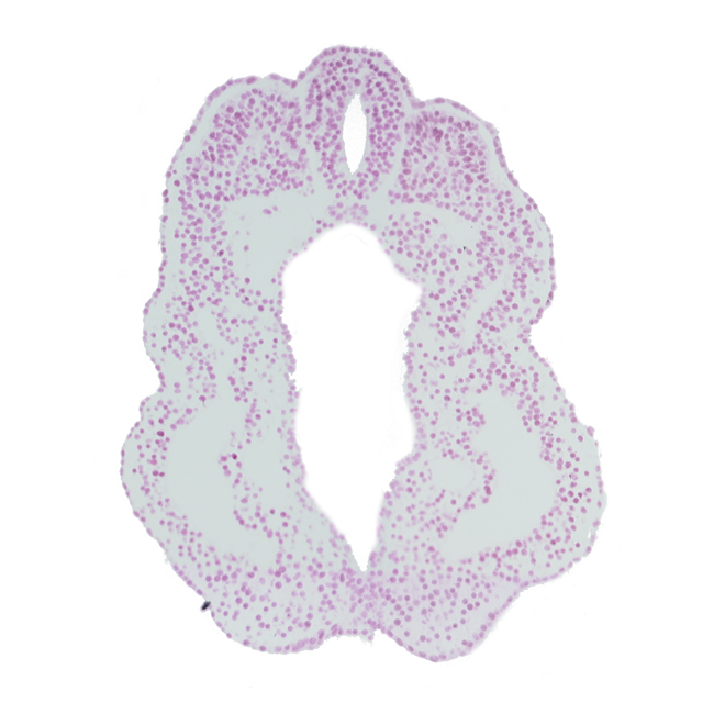 cloacal membrane, cloacal part of hindgut, dorsal aorta, notochord, paraxial mesoderm, peritoneal cavity (coelom), spinal part of neural tube, surface ectoderm