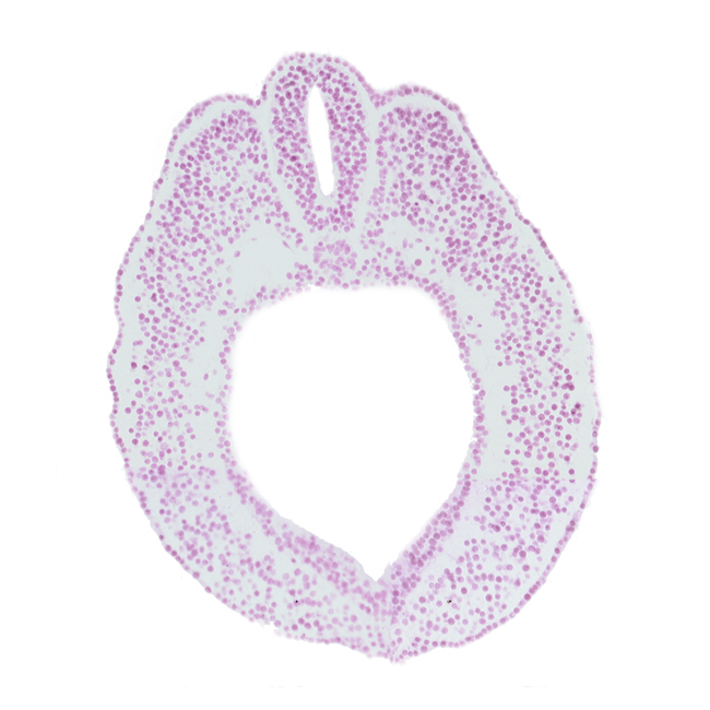 cloacal part of hindgut, dorsal aorta, dorsal aorta plexus, endoderm, lateral mesoderm, notochord, paraxial mesoderm, spinal part of neural tube