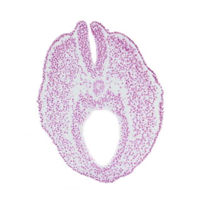 cloacal part of hindgut, dorsal aorta plexus, neural fold, neural groove, notochord, paraxial mesoderm, tangentially cut endoderm