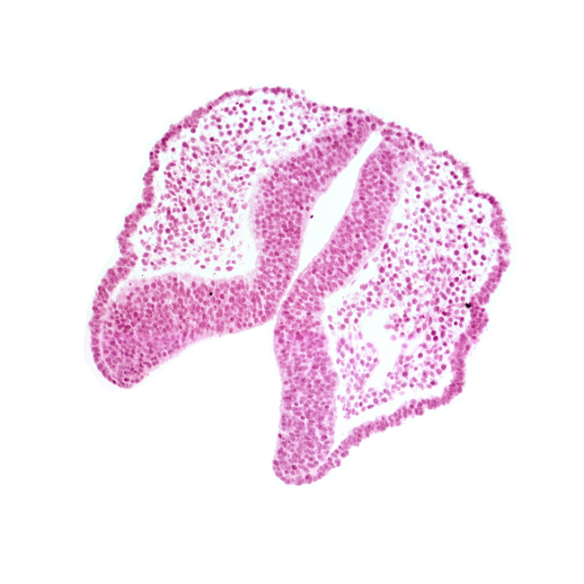 cephalic part of dorsal aorta, fused neural folds, internal carotid artery, junction of neural ectoderm and surface ectoderm, neural fold [diencephalon (D1)], neural fold [diencephalon (D2)], neural fold [mesencephalon (M)], neural groove, rhombencephalon (Rh. 1)