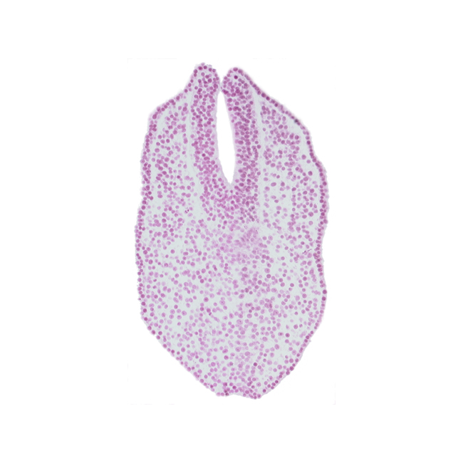 amniotic cavity, caudal edge of neural plate, caudal edge of notochord, caudal eminence, caudal neuropore, gastrulation (primitive) streak, neural fold, paraxial mesoderm