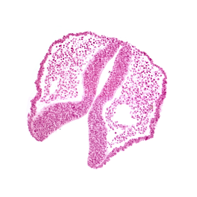 artifact space(s), dorsal aorta, neural fold [diencephalon (D1)], neural fold [diencephalon (D2)], neural fold [mesencephalon (M)], neural groove, rhombencephalon (Rh. 1)