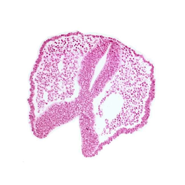 artifact space(s), chiasmatic plate (D1), dorsal aorta, floor plate of neural folds [diencephalon (D2)], head mesenchyme, neural fold [diencephalon (D1)], neural fold [mesencephalon (M)], rhombencephalon (Rh. 1), surface ectoderm