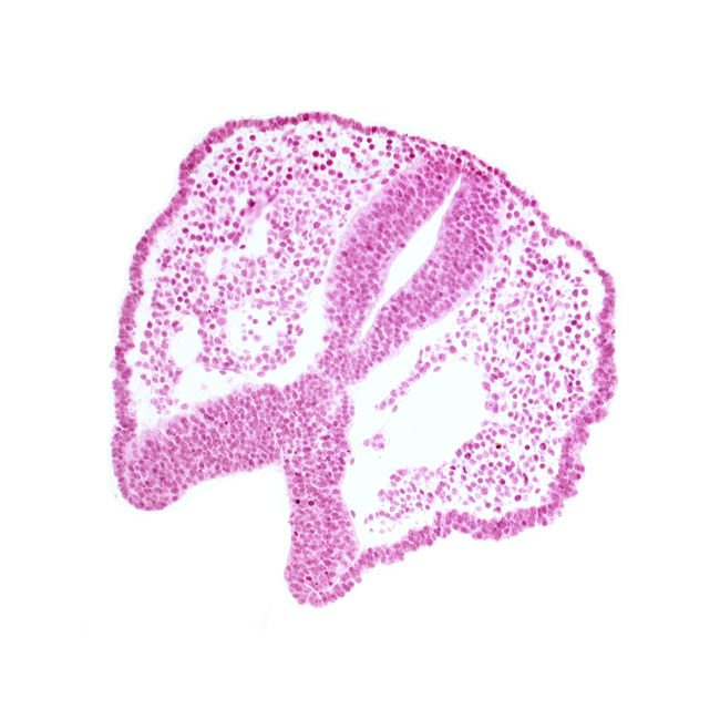 artifact space(s), chiasmatic plate (D1), dorsal aorta, floor plate [diencephalon (D2)], rhombencephalon (Rh. 2), tectum of mesencephalon, tegmentum of mesencephalon, trigeminal neural crest (CN V)