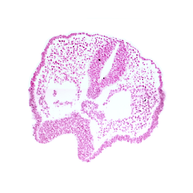 artifact space(s), cephalic end of notochord, chiasmatic plate (D1), dorsal aorta, ectodermal ring, edge of foregut endoderm, floor plate of neural folds, neural fold [diencephalon (D1)], neural groove, rhombencephalon (Rh. 2), surface ectoderm, trigeminal neural crest (CN V)