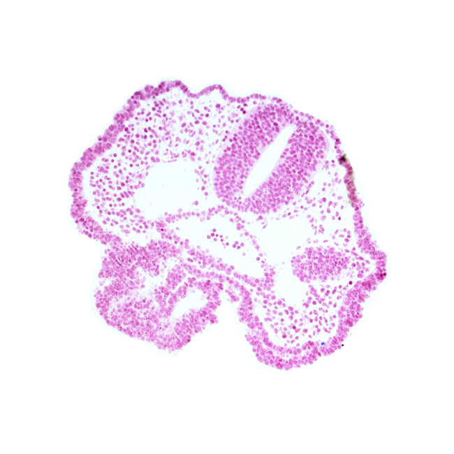 adenohypophysial pouch, aortic arch 1, cephalic edge of neural fold [telencephalon medium (T)], cephalic edge of pharyngeal pouch 1, dorsal aorta, endoderm, foregut lumen, junction of aortic arch 1 and dorsal aorta, mandibular prominence of pharyngeal arch 1, notochordal plate, oropharyngeal membrane, rhombencephalon (Rh. 2), surface ectoderm