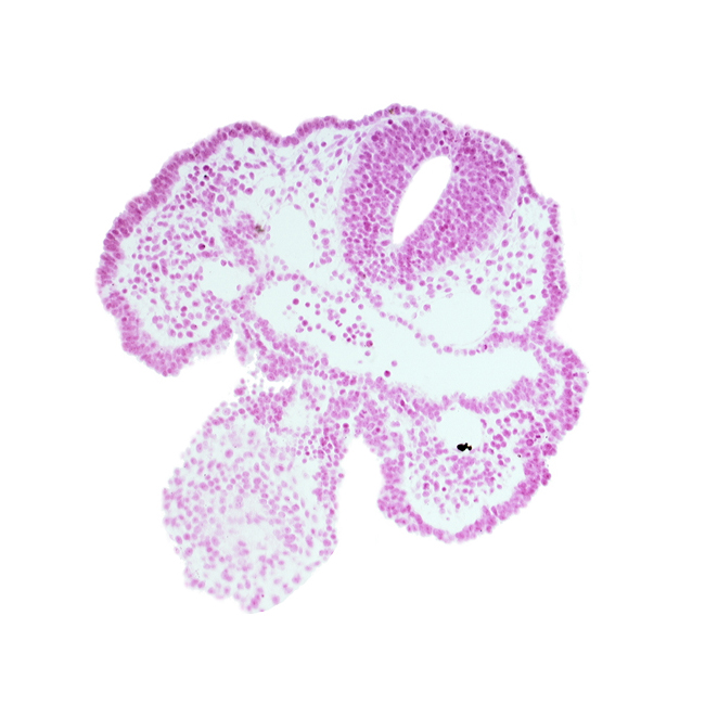 caudal part of stomodeum, cephalic part of heart prominence, head mesenchyme, neural tube, notochord, pharyngeal arch 2, pharyngeal groove 1, pharyngeal membrane, pharyngeal pouch 1, surface ectoderm, surface ectoderm (one layer)