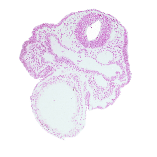 aortic arch 1, cardiac jelly, dorsal aorta, epimyocardium, facio-vestibulocochlear neural crest (CN VII and CN VIII), notochordal plate, primary head vein, rhombencephalon (Rh. 4), surface ectoderm