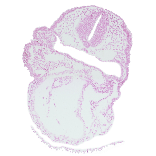 aortic arch 1, cephalic edge of aortic sac, cephalic part of otic placode, conotruncus, dorsal aorta, lateral pharyngeal recess, pericardial cavity, primary head vein, right ventricle