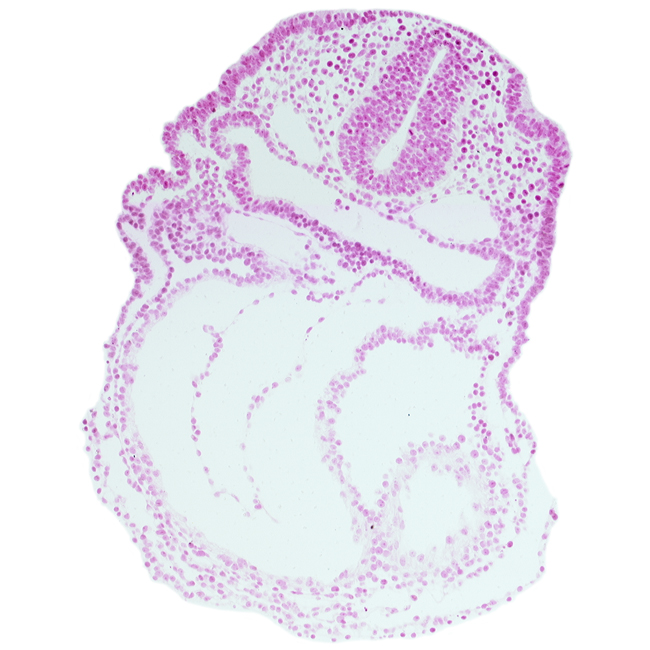 aortic sac, cardiac jelly, cephalic edge of left ventricle, conotruncus, dorsal aorta, epimyocardium, foregut lumen, otic placode, pericardial cavity, right ventricle