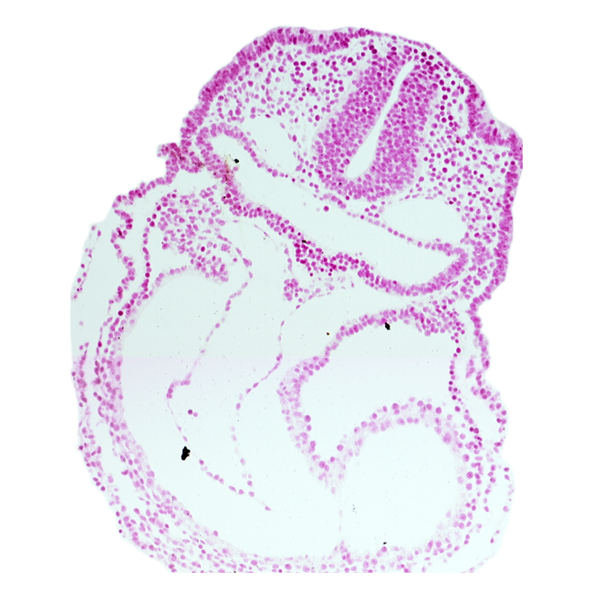 aortic sac, cardiac jelly, conotruncus, dorsal aorta, junction of aortic arch 1 and aortic sac, lateral pharyngeal recess, otic placode, rhombencephalon (Rh. 5), right ventricle