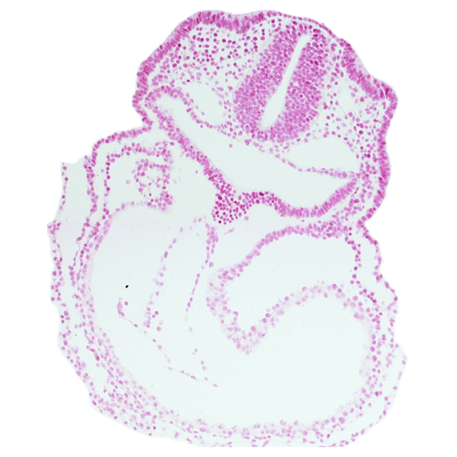 aortic sac, cardiac jelly, conotruncus, endocardium, epimyocardium, head mesenchyme, otic placode, pericardial cavity, primary head vein, rhombencephalon (Rh. 5), right ventricle, thyroid diverticulum