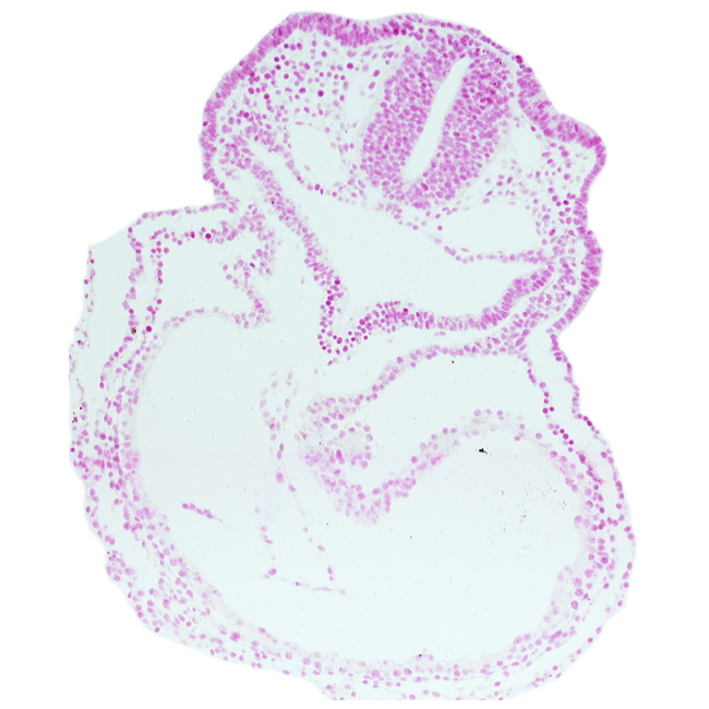 dorsal aorta, otic placode, pericardial cavity, primary head vein, right ventricle, thyroid diverticulum