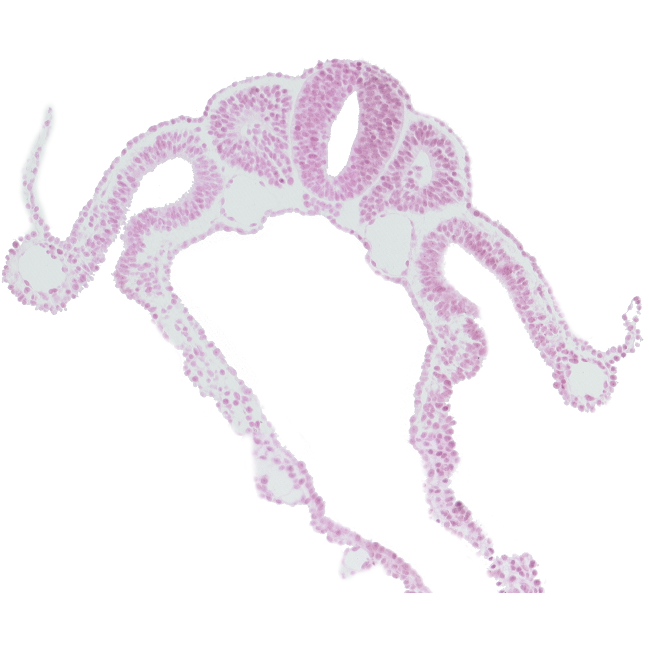 amniotic cavity, dermatomyotome 7 (C-3), dorsal aorta, notochord, sclerotome, somitocoel 7