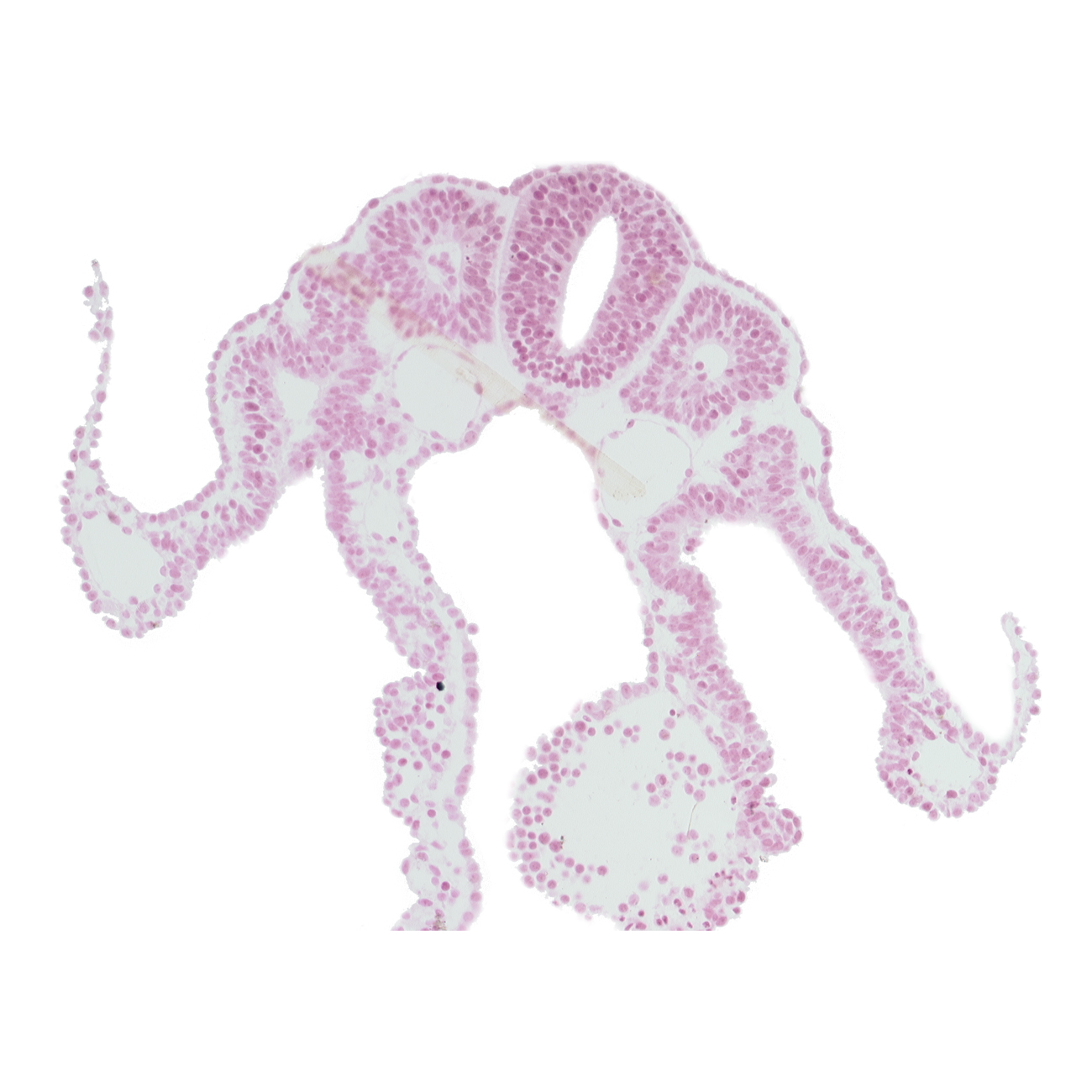 dermatomyotome 9 (C-5), intermediate mesenchyme, lateral body fold, midgut, notochord, somitocoel 9