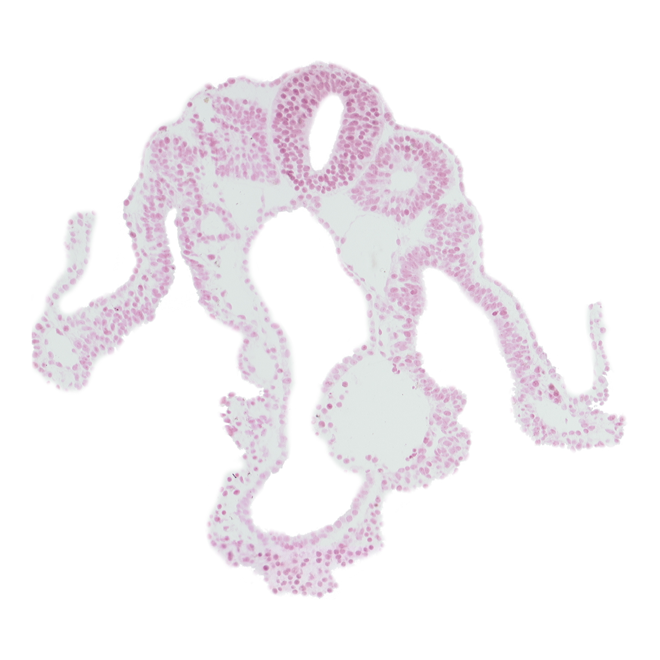 intermediate mesenchyme, lateral body fold, left umbilical vein, lumen of neural tube, midgut, notochord, peritoneal cavity (coelom), somite 10 (C-6), somitocoel 10