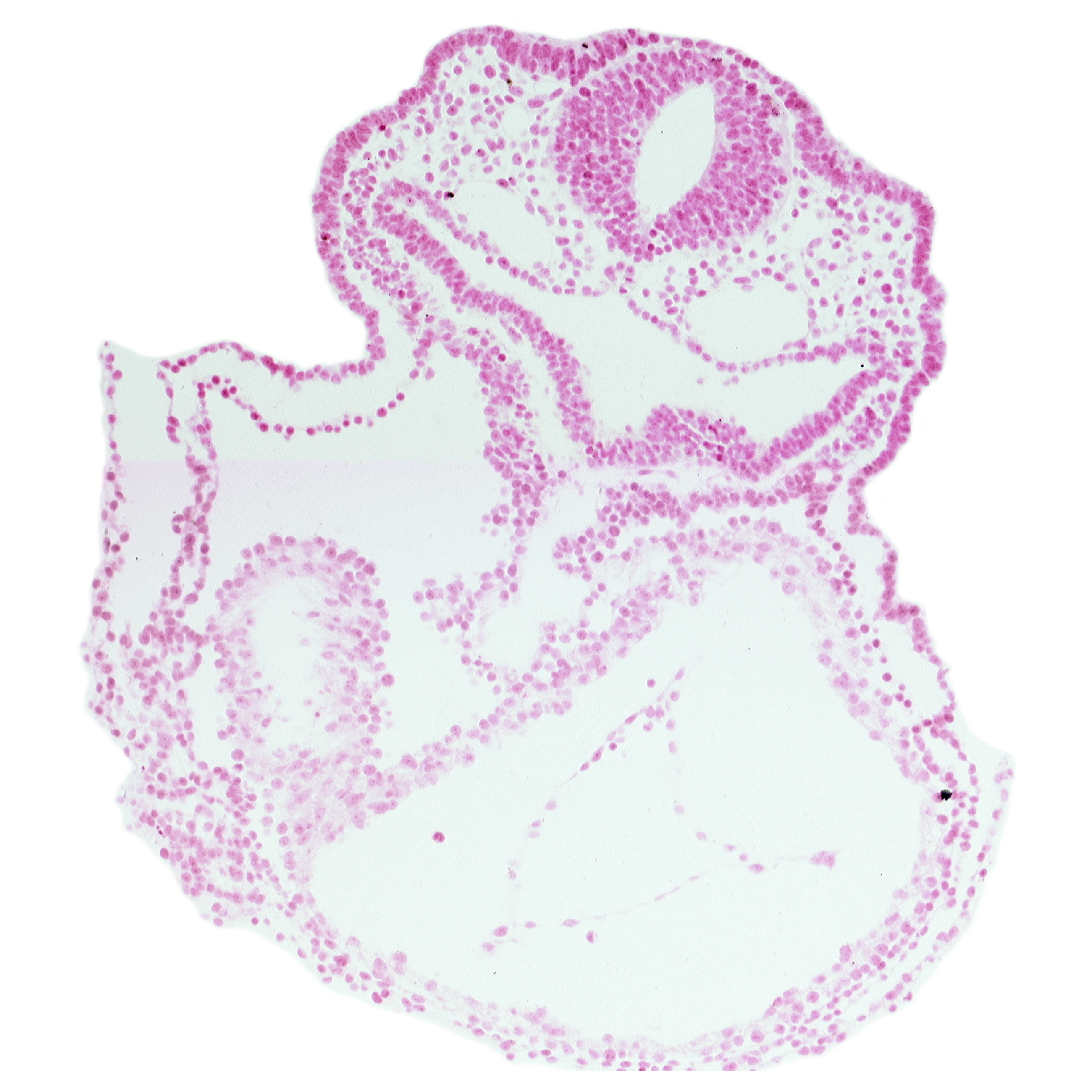 amnion attachment, cardiac jelly, caudal part of right ventricle (epimyocardium), foregut, laryngotracheal groove, lateral pharyngeal recess, left ventricle, otic placode, pericardial cavity, rhombencephalon (Rh. 5), surface ectoderm