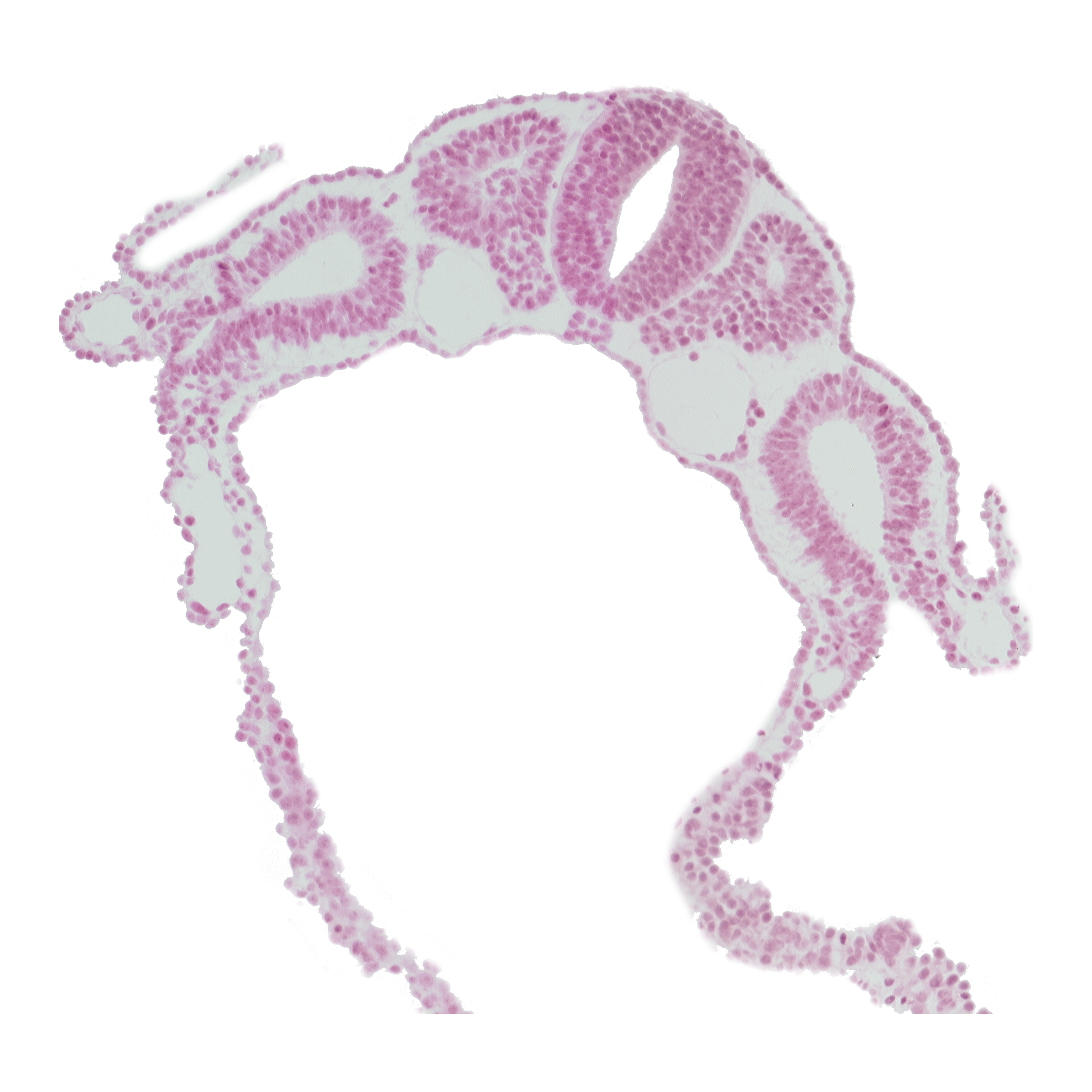 amniotic cavity, communication between peritoneal cavity and extra-embryonic coelom, dermatomyotome 5 (C-1), dorsal aorta, left umbilical vein, sclerotome, somitocoel 5, vitelline (omphalomesenteric) vein