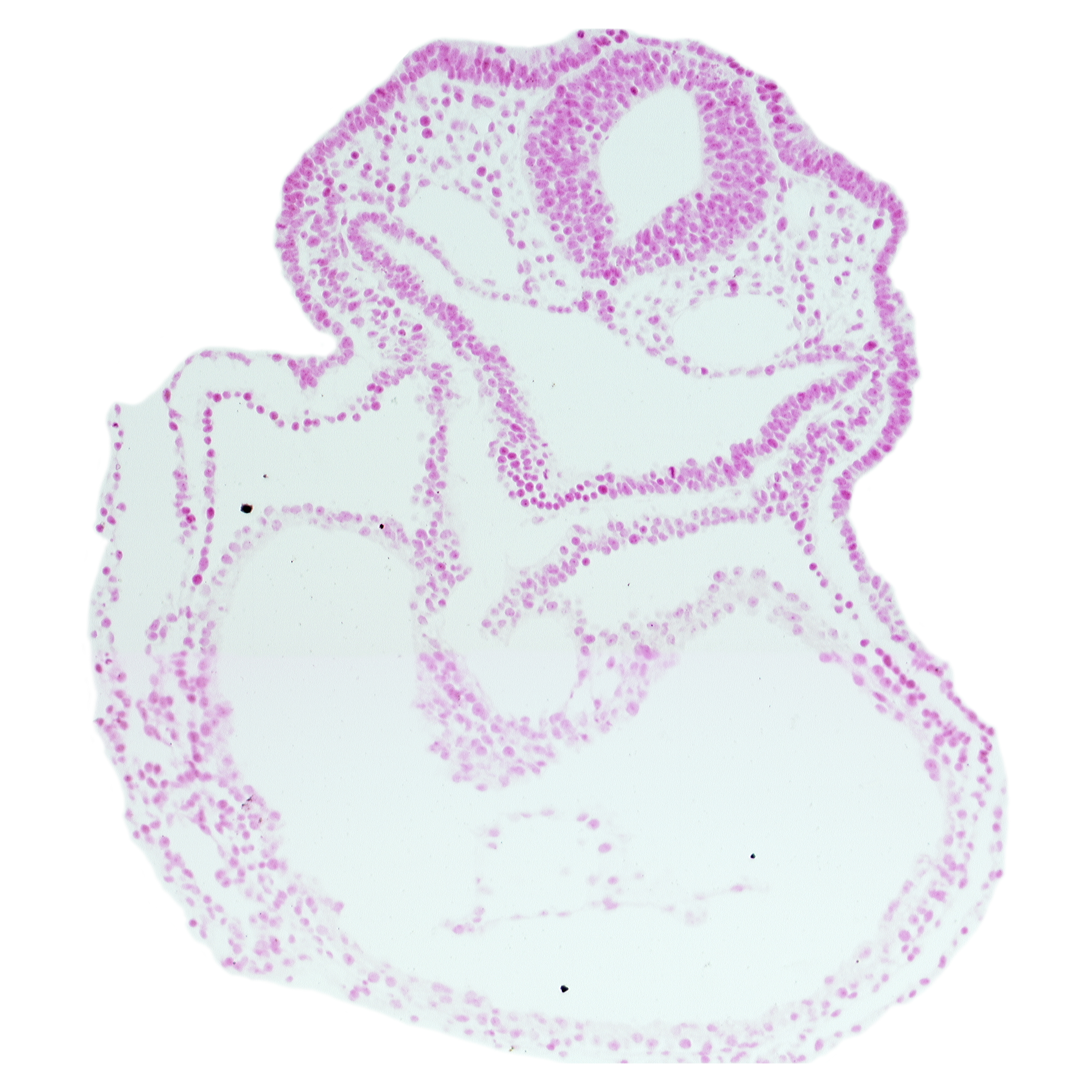 amnion attachment, cardiac jelly, caudal edge of thyroid diverticulum, dorsal aorta, epimyocardium, head mesenchyme, junction of left and right ventricles, lateral pharyngeal recess, mesocardium, notochordal plate, otic placode, pericardial cavity, rhombencephalon (Rh. 5), surface ectoderm