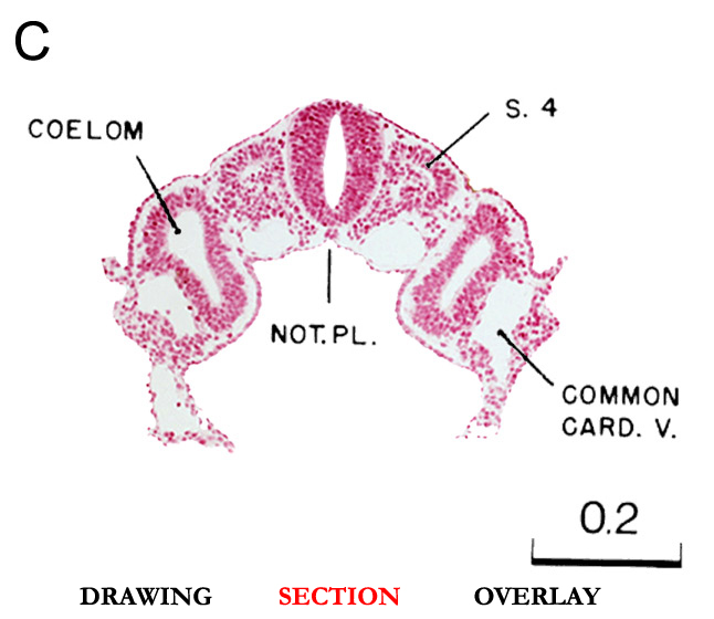 Slice C section