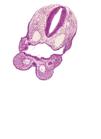 aortic arch 1, aortic arch 2, caudal edge of pharyngeal pouch 1, cephalic edge of dermatomyotome 1 (O-1), cephalic edge of thyroid diverticulum, head mesenchyme, junction of precardinal and primary head veins, median mandibular groove, notochord, pharyngeal arch 1 mesenchyme, pharyngeal membrane 2, pharyngeal pouch 2, pharynx, rhombencephalon (Rh. D)