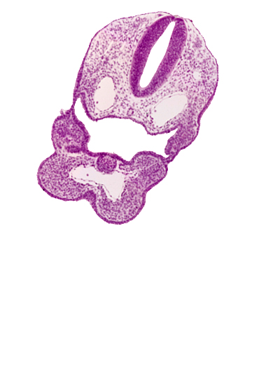 aortic sac, caudal edge of median mandibular groove, dermatomyotome 1 (O-1), dorsal aorta, ectodermal ring, origin of aortic arch 2, pharyngeal arch 3, pharyngeal groove 1, pharyngeal groove 2, pharyngeal membrane, pharyngeal pouch 2, pharyngeal pouch 3, precardinal vein, rhombencephalon (Rh. D), rhombencoel (fourth ventricle), thyroid diverticulum