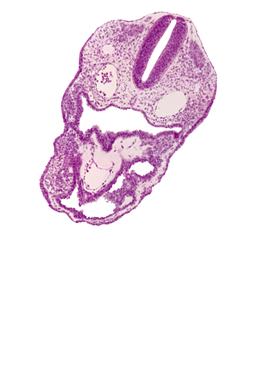 aortic sac, dermatomyotome 2 (O-2) , dorsal aorta, notochord, pericardial cavity, pharyngeal pouch 3, pharynx, rhombencephalon (Rh. D)