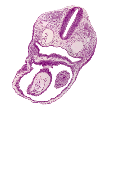 cephalic edge of left atrium, dermatomyotome 2 (O-2) , junction of aortic sac and truncus arteriosus, notochord, pericardial cavity, pericardial sac, pharyngeal pouch 4, pharynx, precardinal vein