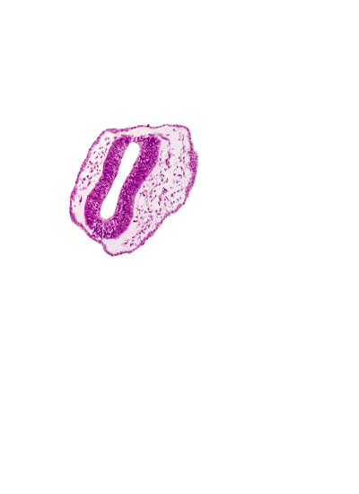 head mesenchyme, mesencephalon (M2), mesencoel, rhombencephalon (Rh. 1), rhombencoel (fourth ventricle), surface ectoderm