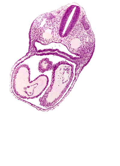 atrioventricular canal, cardiac jelly, conus cordis, dermatomyotome 3 (O-3) , dorsal aorta, ectodermal ring, endocardium, epimyocardium, left atrium, left ventricle, notochord, pericardial cavity, pharyngeal pouch 4, pharynx, precardinal vein, rhombencephalon (Rh. D), right atrium, sclerotome, truncus arteriosus