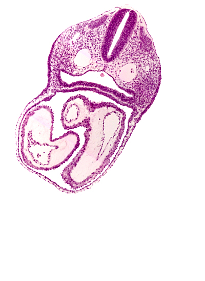 atrioventricular canal, cardiac jelly, conus cordis, dermatomyotome 3 (O-3) , dorsal aorta, ectodermal ring, endocardium, epimyocardium, floor of interatrial sulcus, left atrium, left ventricle, notochord, pericardial cavity, pharyngeal pouch 4, pharynx, precardinal vein, rhombencephalon (Rh. D), right atrium, sclerotome, truncus arteriosus