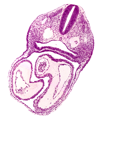atrioventricular canal, conus cordis, dermatomyotome 3 (O-3) , interatrial sulcus, left atrium, left ventricle, notochord, pharyngeal pouch 4, precardinal vein, right atrium, sclerotome, sulcus limitans